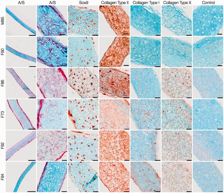 https://cdn.ncbi.nlm.nih.gov/pmc/blobs/c45d/4274334/57b6421bcc36/10.1177_0885328214548604-fig7.jpg