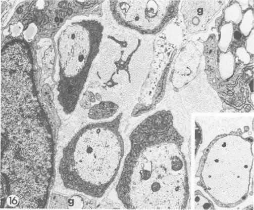 https://cdn.ncbi.nlm.nih.gov/pmc/blobs/c45e/1903405/640d35b45aad/amjpathol00233-0126-a.jpg