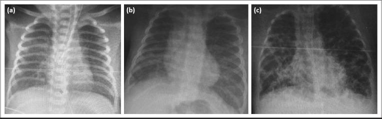 https://cdn.ncbi.nlm.nih.gov/pmc/blobs/c45e/7750334/3293d4cfdd09/TPA-55-425-g002.jpg