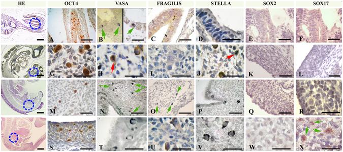 https://cdn.ncbi.nlm.nih.gov/pmc/blobs/c463/5429608/24cd315e56c6/41598_2017_723_Fig5_HTML.jpg