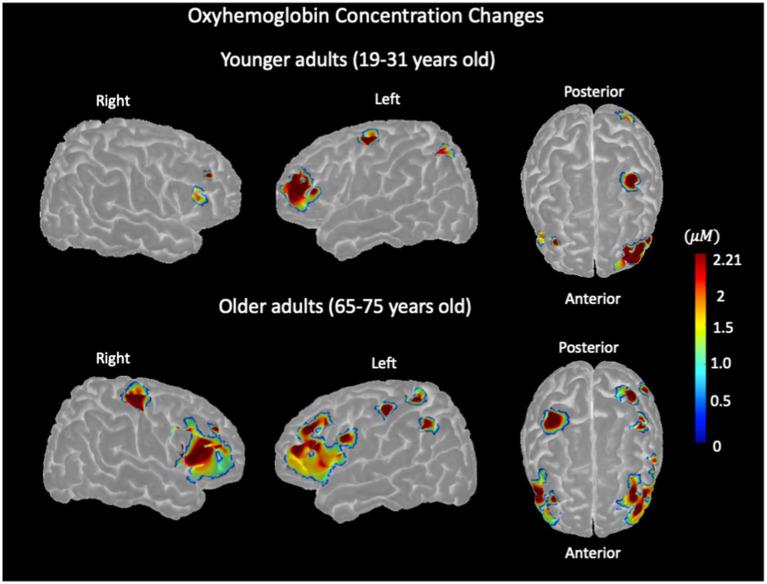 https://cdn.ncbi.nlm.nih.gov/pmc/blobs/c469/12129889/eedb89606ee0/fnagi-17-1486775-g004.jpg