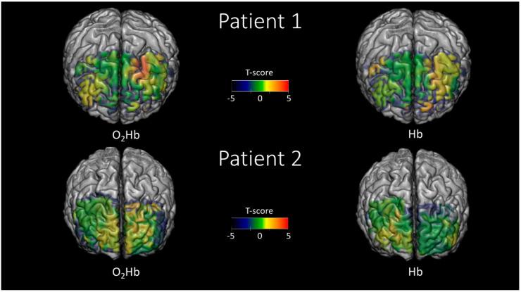 https://cdn.ncbi.nlm.nih.gov/pmc/blobs/c476/7503954/6b5f25a03576/ijms-21-06273-g007.jpg