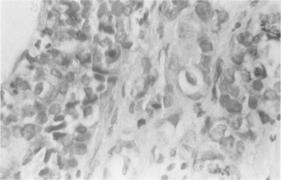 https://cdn.ncbi.nlm.nih.gov/pmc/blobs/c484/1396099/06edf655b5fd/annsurg00373-0121-b.jpg