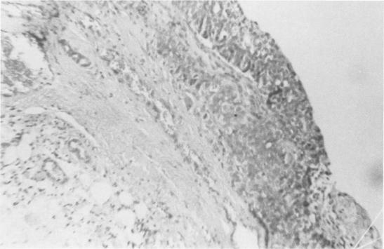https://cdn.ncbi.nlm.nih.gov/pmc/blobs/c484/1396099/2b1397fa83b9/annsurg00373-0121-a.jpg
