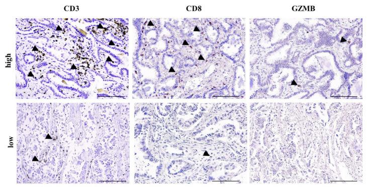 https://cdn.ncbi.nlm.nih.gov/pmc/blobs/c486/8037524/ad07c907580a/cancers-13-01658-g001.jpg