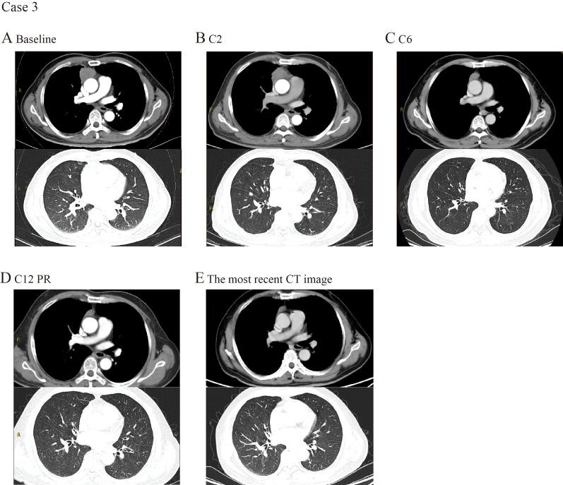 https://cdn.ncbi.nlm.nih.gov/pmc/blobs/c489/12149142/771eb29abec0/fimmu-16-1516297-g002.jpg