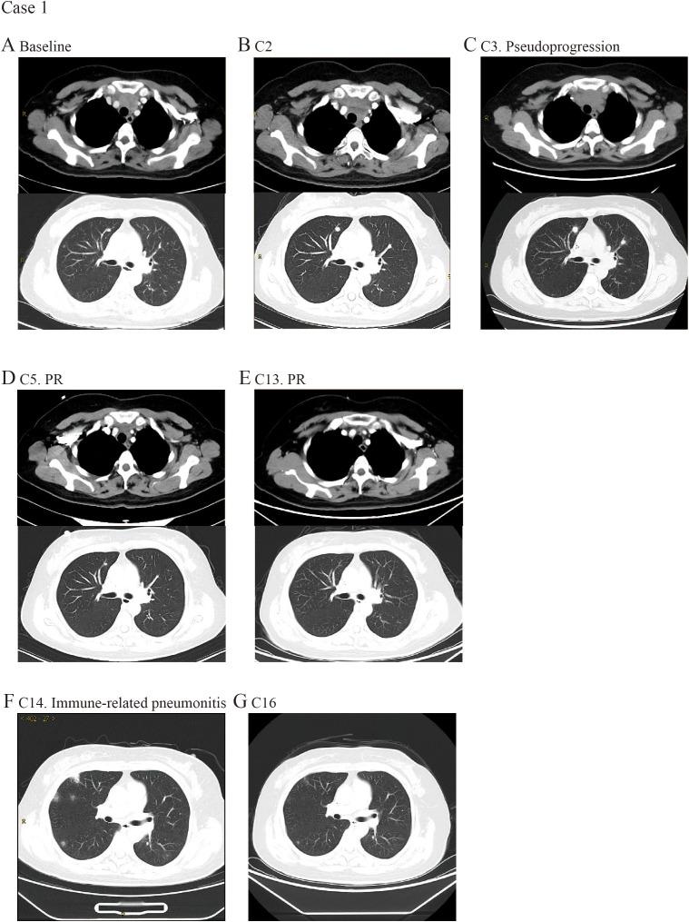 https://cdn.ncbi.nlm.nih.gov/pmc/blobs/c489/12149142/8cc8942184e5/fimmu-16-1516297-g001.jpg