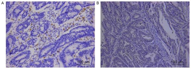 https://cdn.ncbi.nlm.nih.gov/pmc/blobs/c48d/5652949/2063d9a51c24/OR-38-04-2003-g05.jpg