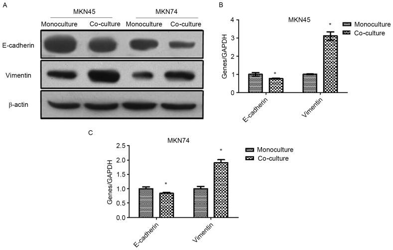 https://cdn.ncbi.nlm.nih.gov/pmc/blobs/c48d/5652949/8474e4f37578/OR-38-04-2003-g01.jpg