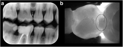 https://cdn.ncbi.nlm.nih.gov/pmc/blobs/c48d/5689175/476dcfebf660/12903_2017_421_Fig2_HTML.jpg