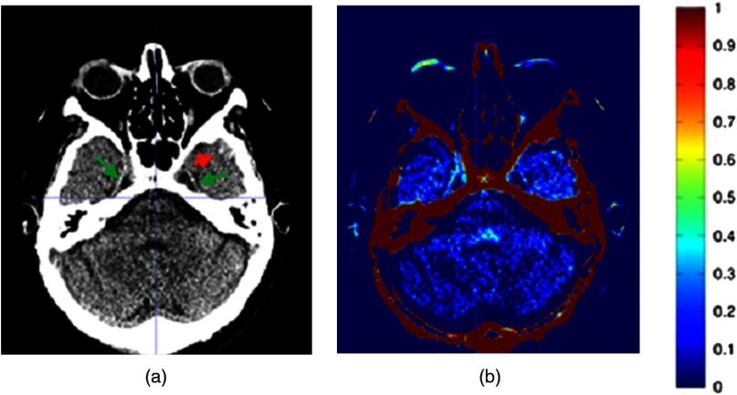 https://cdn.ncbi.nlm.nih.gov/pmc/blobs/c491/5960809/19ce9cb8be89/JMI-005-024004-g003.jpg