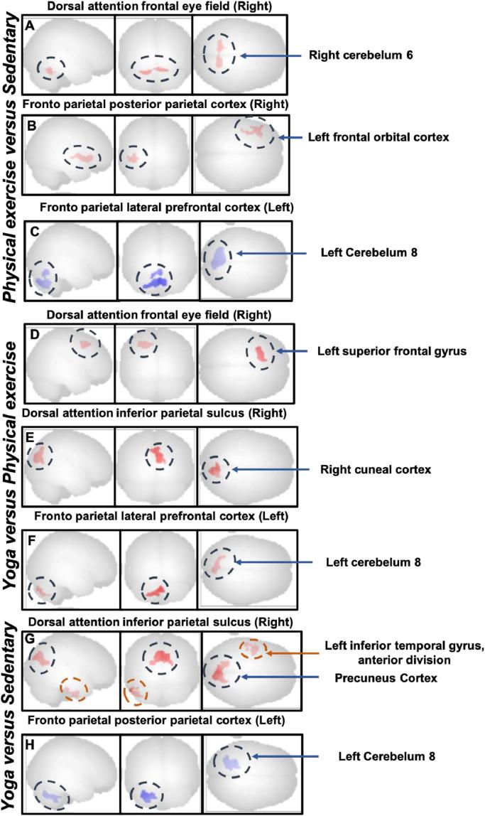 https://cdn.ncbi.nlm.nih.gov/pmc/blobs/c492/8237306/f934d5aa3eb9/gr6.jpg