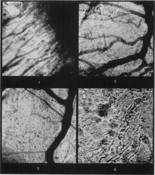 https://cdn.ncbi.nlm.nih.gov/pmc/blobs/c496/2073422/7ba633eabcc2/brjexppathol00053-0034-a.jpg