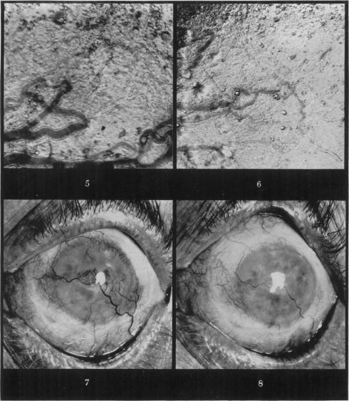 https://cdn.ncbi.nlm.nih.gov/pmc/blobs/c496/2073422/7cb1fa0e29e0/brjexppathol00053-0035-a.jpg