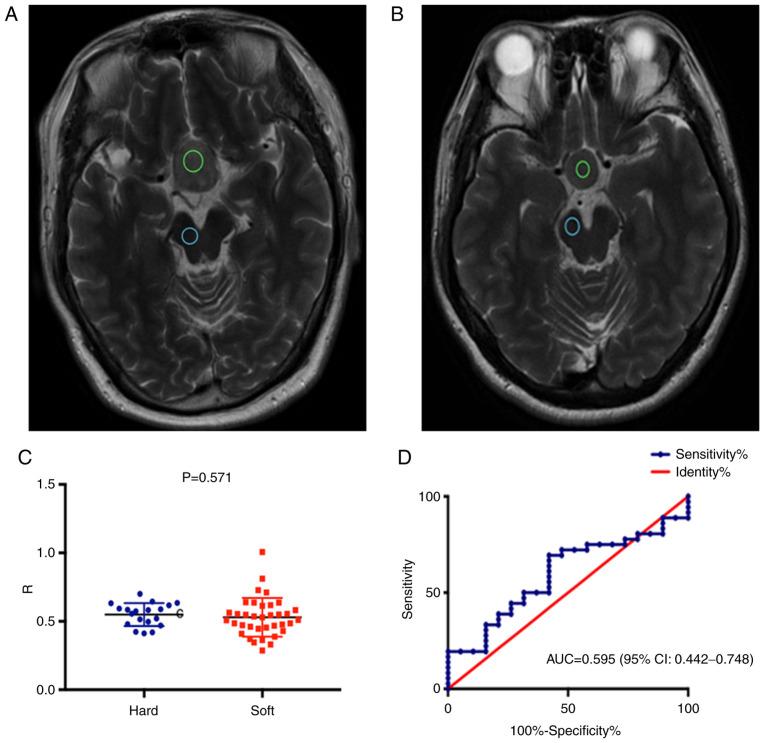 https://cdn.ncbi.nlm.nih.gov/pmc/blobs/c49a/8453341/59374c190874/etm-22-05-10690-g03.jpg