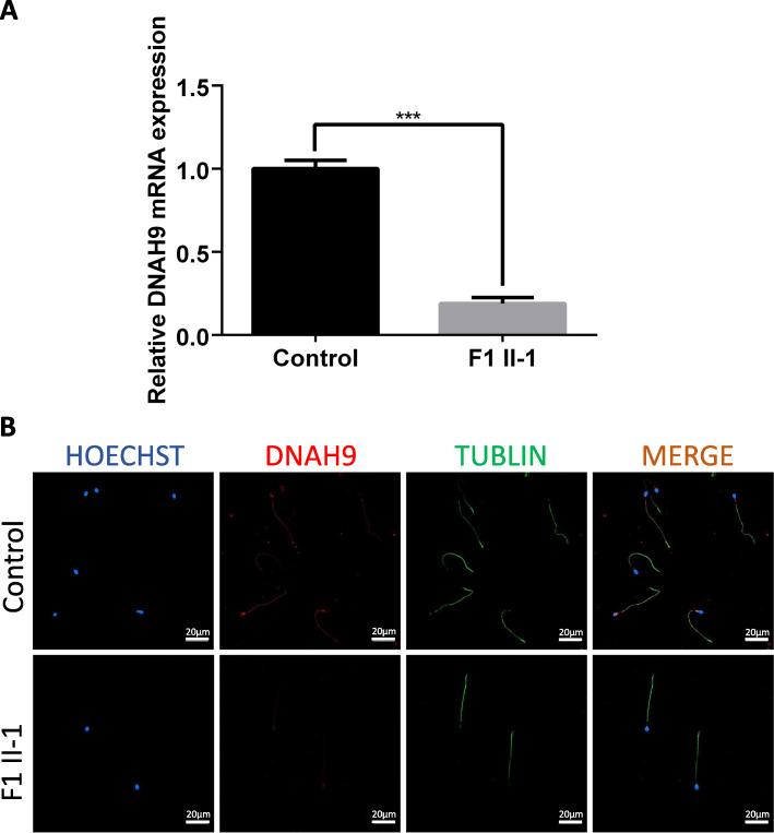 https://cdn.ncbi.nlm.nih.gov/pmc/blobs/c49b/7896388/7e22e20323dc/12958_2021_709_Fig2_HTML.jpg