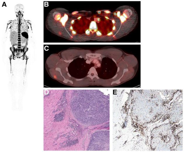 https://cdn.ncbi.nlm.nih.gov/pmc/blobs/c4a0/10333708/ac158aee2639/fmed-10-1199146-g0005.jpg
