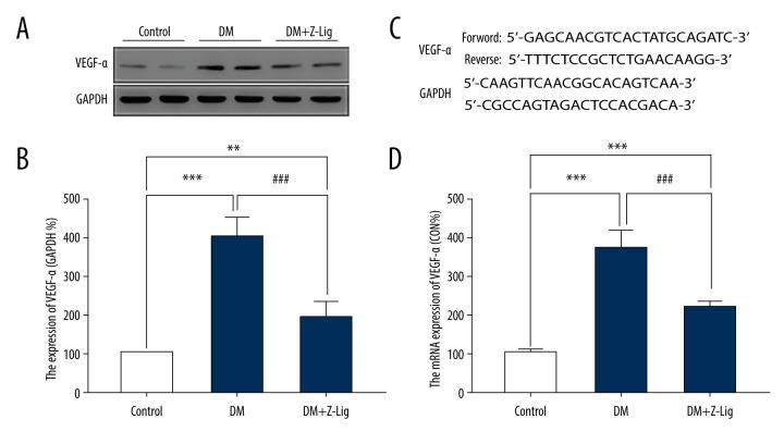 https://cdn.ncbi.nlm.nih.gov/pmc/blobs/c4a0/7542994/fe3d0c461643/medscimonit-26-e925087-g005.jpg
