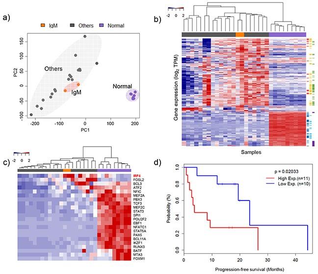 https://cdn.ncbi.nlm.nih.gov/pmc/blobs/c4a7/5216929/3d123be1b037/oncotarget-07-47127-g003.jpg