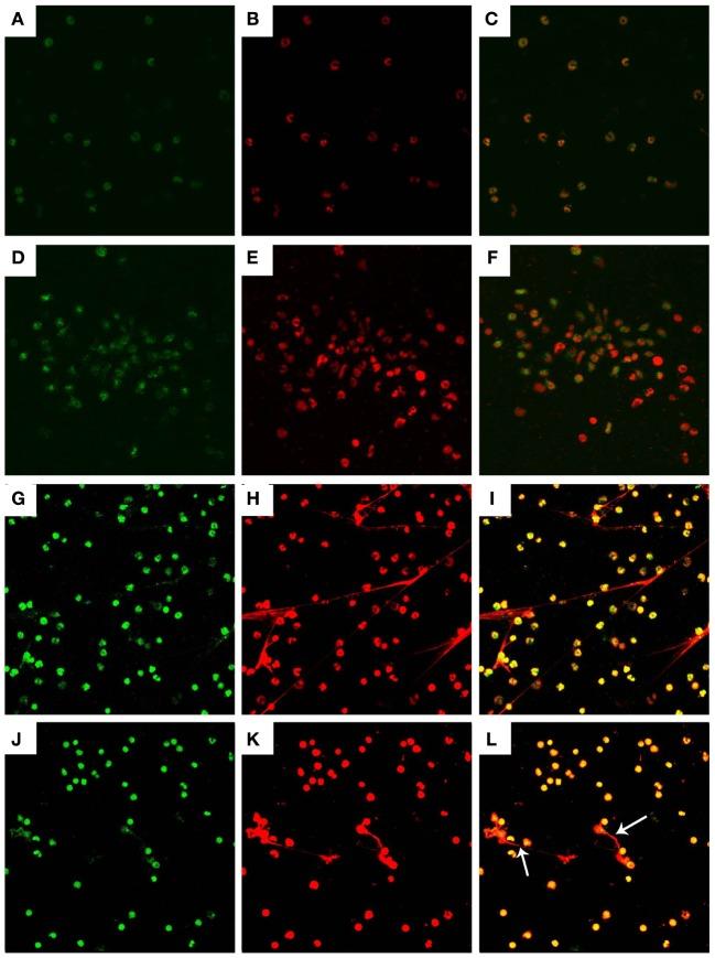 https://cdn.ncbi.nlm.nih.gov/pmc/blobs/c4a9/5780343/dbe0a965383c/fimmu-08-02016-g002.jpg