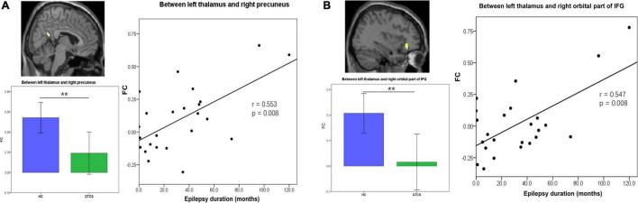 https://cdn.ncbi.nlm.nih.gov/pmc/blobs/c4ab/9353948/bfdd96fafa02/fnins-16-953356-g004.jpg