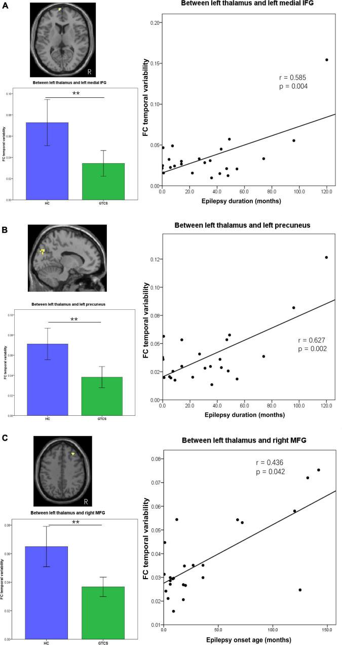 https://cdn.ncbi.nlm.nih.gov/pmc/blobs/c4ab/9353948/cf3ca44940f1/fnins-16-953356-g005.jpg