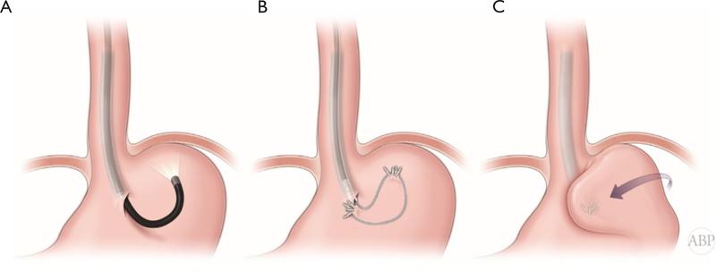 https://cdn.ncbi.nlm.nih.gov/pmc/blobs/c4ae/10128619/97efb60fccbd/nihms-1762115-f0003.jpg
