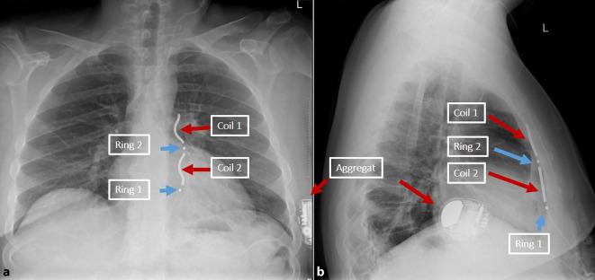 https://cdn.ncbi.nlm.nih.gov/pmc/blobs/c4b2/11347474/4a8b1f0b058d/399_2024_1042_Fig3_HTML.jpg