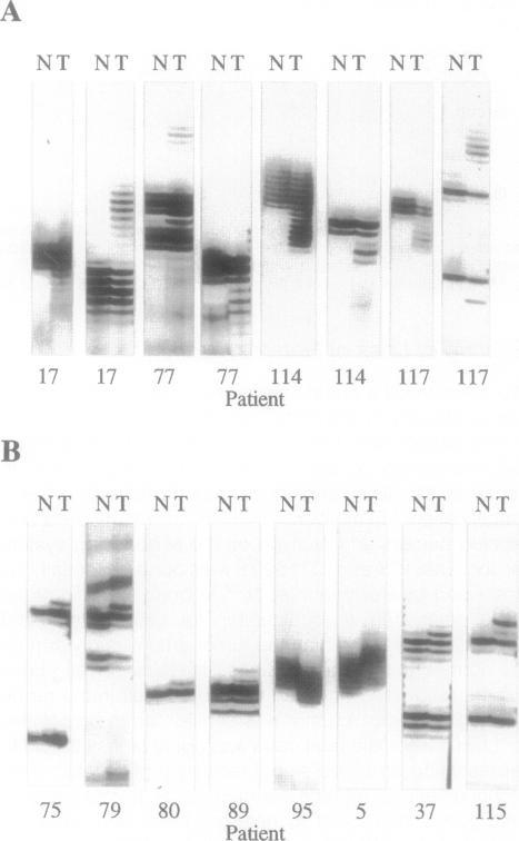 https://cdn.ncbi.nlm.nih.gov/pmc/blobs/c4b6/1858584/f6ee9287c41c/amjpathol00017-0174-a.jpg