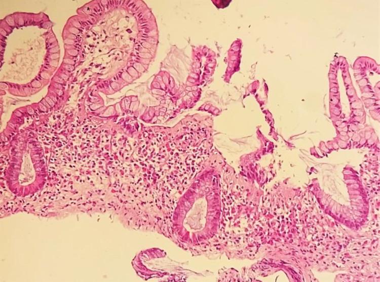 https://cdn.ncbi.nlm.nih.gov/pmc/blobs/c4c2/10105505/2623554603fb/GHFBB-16-532-g003.jpg