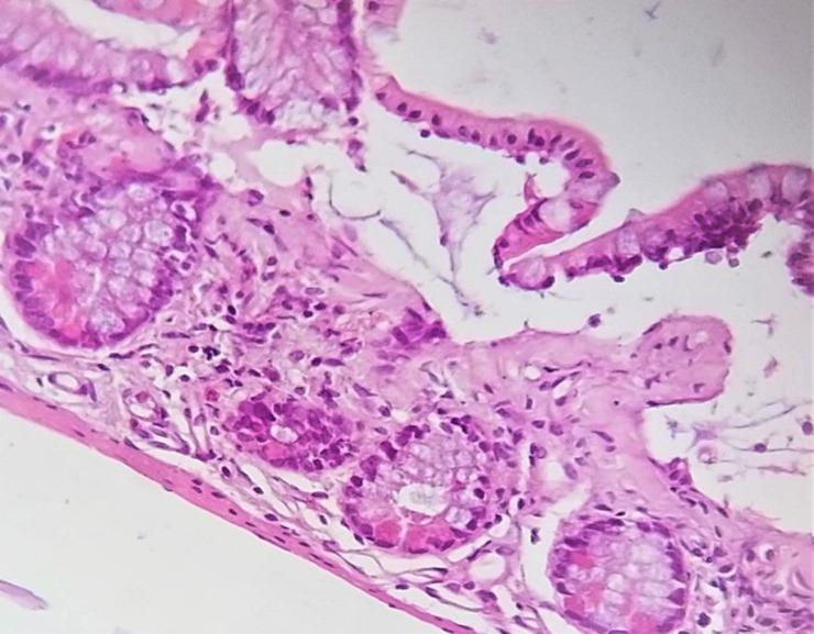 https://cdn.ncbi.nlm.nih.gov/pmc/blobs/c4c2/10105505/3a27f9b7b45d/GHFBB-16-532-g004.jpg