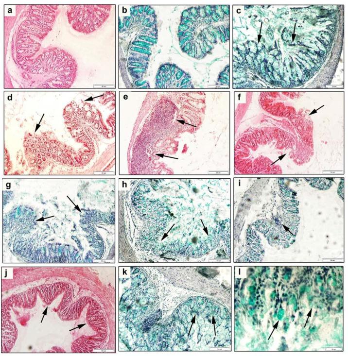https://cdn.ncbi.nlm.nih.gov/pmc/blobs/c4c5/7761014/9b5bd3f5e958/cells-09-02571-g004.jpg