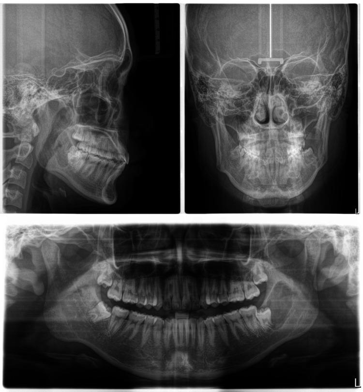 https://cdn.ncbi.nlm.nih.gov/pmc/blobs/c4c8/11333988/c59c51db5068/cureus-0016-00000065024-i14.jpg