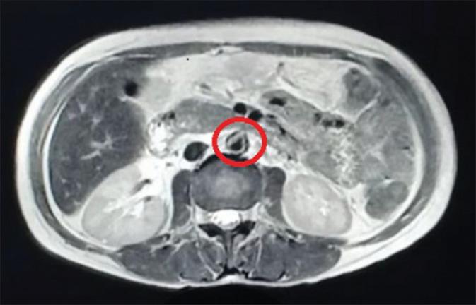 https://cdn.ncbi.nlm.nih.gov/pmc/blobs/c4d2/11044692/0000dde0eab3/IJN-34-2-181-g1.jpg