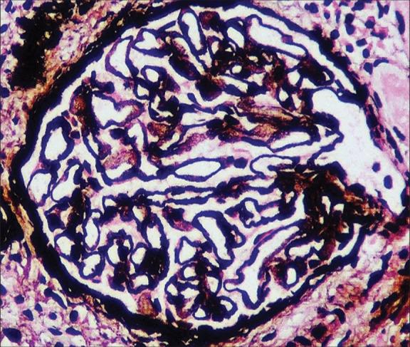 https://cdn.ncbi.nlm.nih.gov/pmc/blobs/c4d2/11044692/7b10938376dc/IJN-34-2-181-g2.jpg