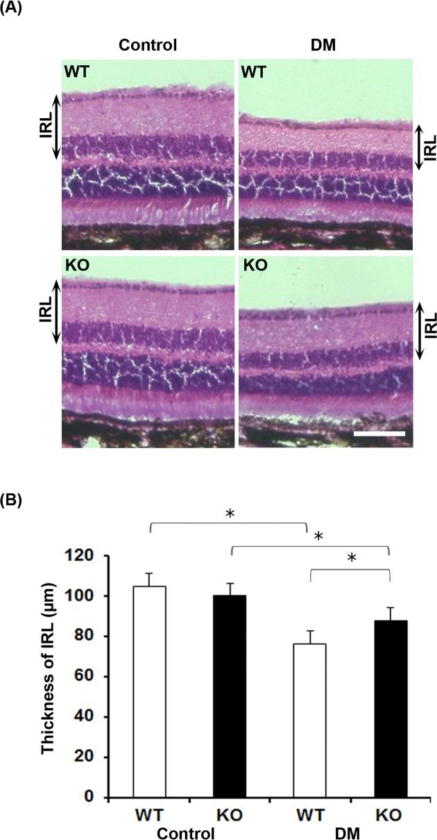 https://cdn.ncbi.nlm.nih.gov/pmc/blobs/c4d3/5755926/65e0c70bfe37/pone.0190864.g004.jpg