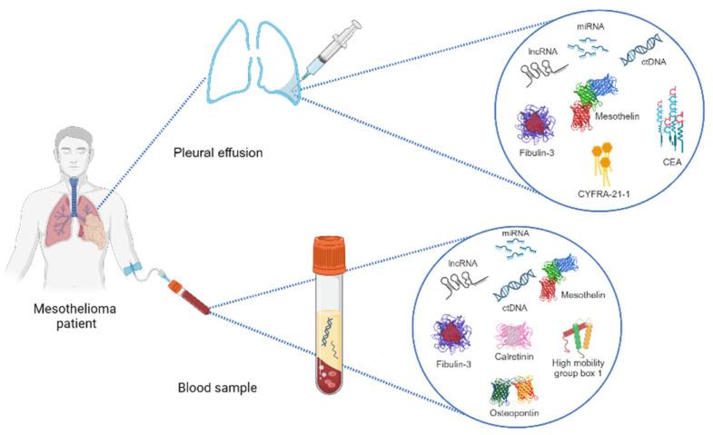https://cdn.ncbi.nlm.nih.gov/pmc/blobs/c4dd/10672377/b07818b41d96/jcm-12-07006-g001.jpg
