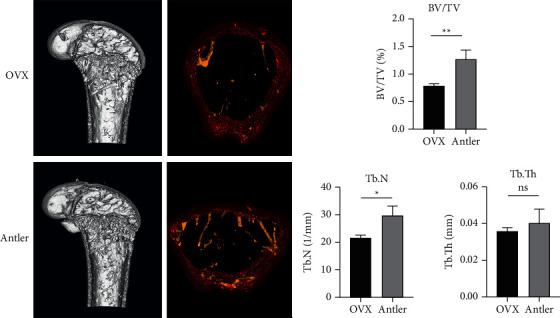 https://cdn.ncbi.nlm.nih.gov/pmc/blobs/c4dd/8523247/d9edba05dd8c/ECAM2021-7144529.008.jpg