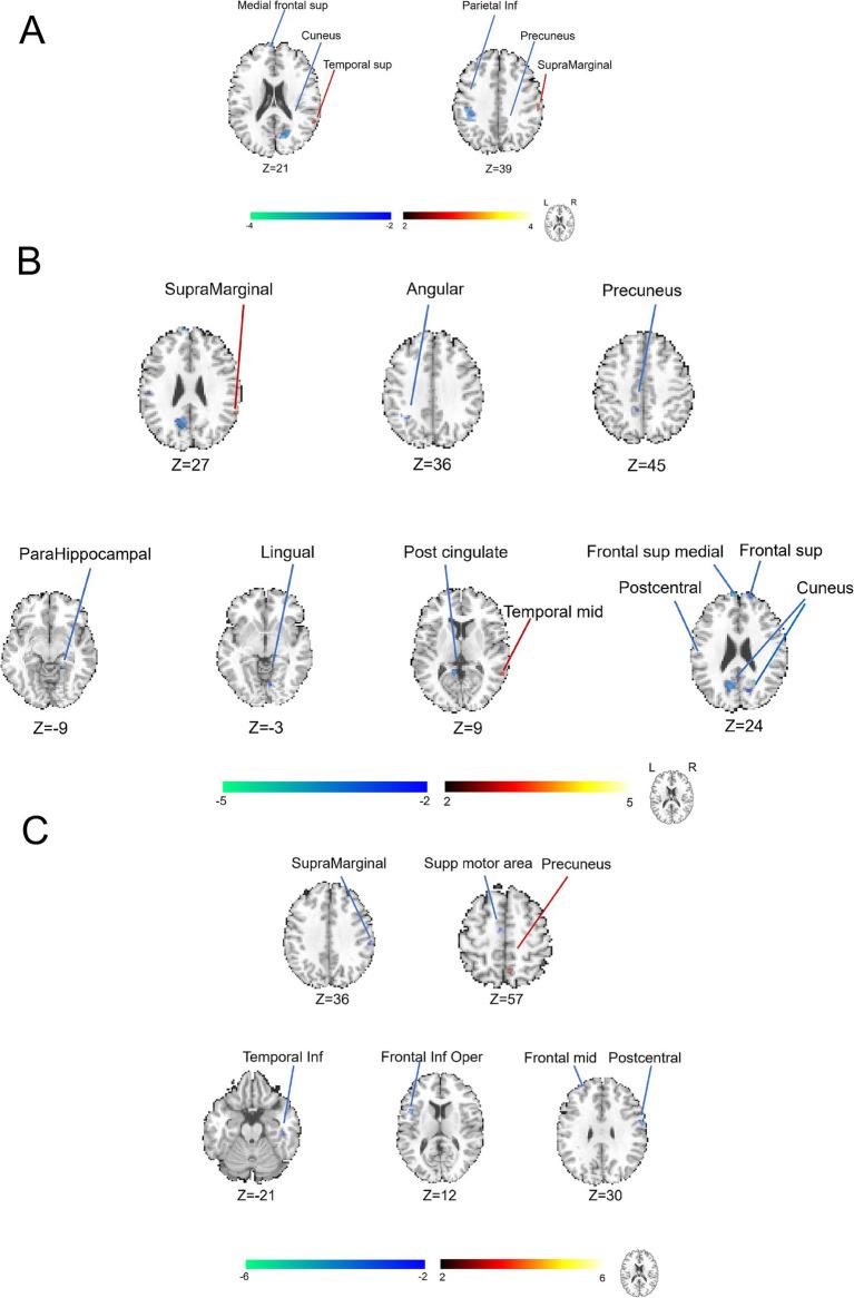 https://cdn.ncbi.nlm.nih.gov/pmc/blobs/c4e4/11897570/904b45f1adcb/fnins-19-1511654-g002.jpg