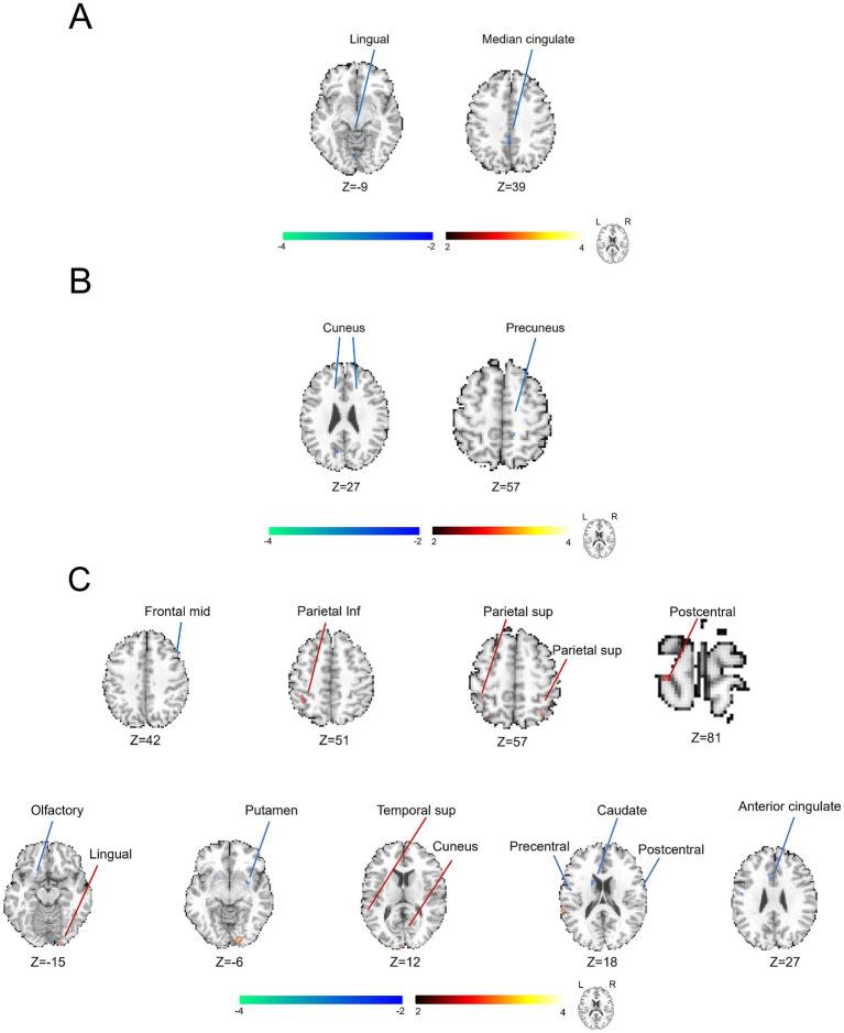 https://cdn.ncbi.nlm.nih.gov/pmc/blobs/c4e4/11897570/b06eac4799f5/fnins-19-1511654-g003.jpg