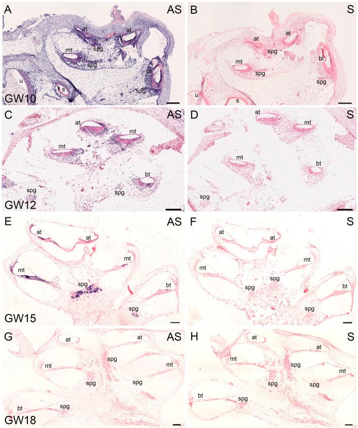 https://cdn.ncbi.nlm.nih.gov/pmc/blobs/c4e7/11641258/1303247c2091/ijms-25-13007-g002.jpg