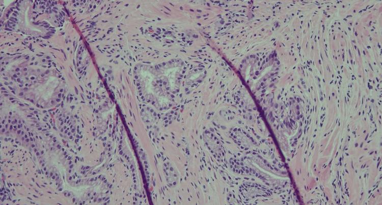 https://cdn.ncbi.nlm.nih.gov/pmc/blobs/c4e9/12370322/1065193e7973/cureus-0017-00000088551-i03.jpg
