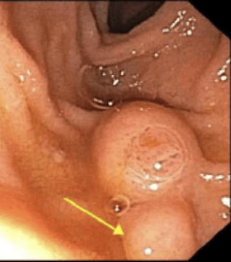https://cdn.ncbi.nlm.nih.gov/pmc/blobs/c4e9/12370322/235b7281a5c5/cureus-0017-00000088551-i01.jpg