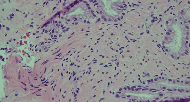 https://cdn.ncbi.nlm.nih.gov/pmc/blobs/c4e9/12370322/52e546d0d535/cureus-0017-00000088551-i04.jpg