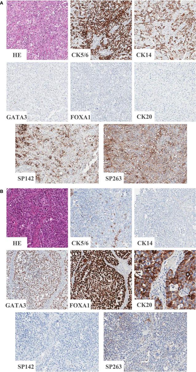 https://cdn.ncbi.nlm.nih.gov/pmc/blobs/c4f4/7750632/769f46d2b41a/fonc-10-527385-g001.jpg