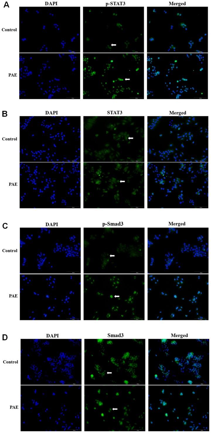 https://cdn.ncbi.nlm.nih.gov/pmc/blobs/c4f5/5504994/63057cfa7ba4/IJMM-40-02-0465-g04.jpg