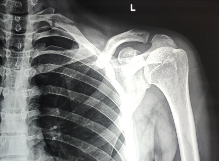 https://cdn.ncbi.nlm.nih.gov/pmc/blobs/c4f6/8103854/f849e1d311d2/cureus-0013-00000014339-i04.jpg