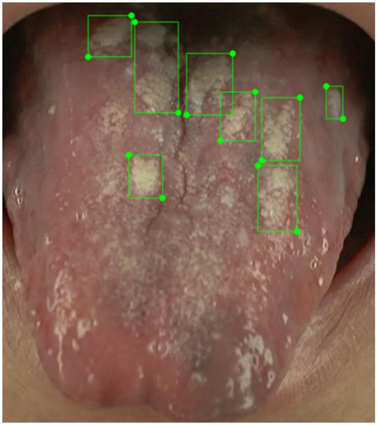 https://cdn.ncbi.nlm.nih.gov/pmc/blobs/c4f8/10919637/a01005176945/pone.0296070.g009.jpg