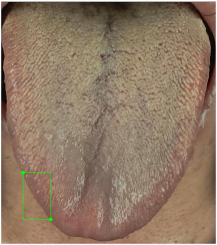 https://cdn.ncbi.nlm.nih.gov/pmc/blobs/c4f8/10919637/c89c4cbac023/pone.0296070.g008.jpg