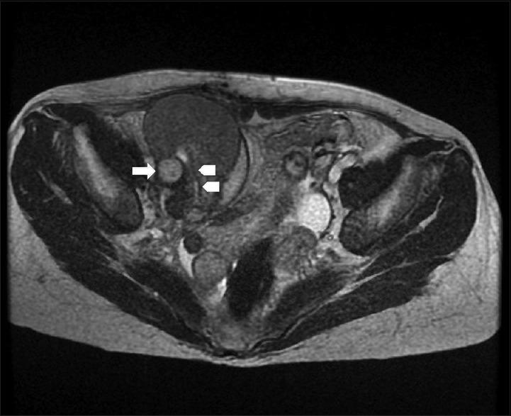 https://cdn.ncbi.nlm.nih.gov/pmc/blobs/c4f9/6172893/c3e96675ec36/TCMJ-30-250-g002.jpg